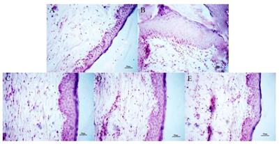 The mechanism of oxymatrine on atopic dermatitis in mice based on SOCS1/JAK-STAT3 pathway
